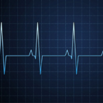 electrocardiogramme