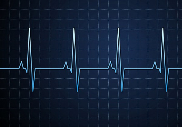 electrocardiogramme