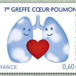 Greffe coeur poumons